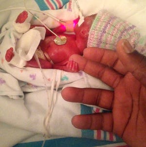 Alana Marie, born at just 24 weeks, grabs onto her father's hand, Antwon Watson, in 2014. Her short life lasted only 36 hours, but Antwon and Marquisse Watson say they were blessed to have that time with her.