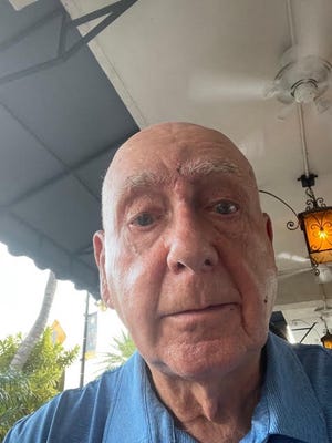 Dick Vitale after having surgery to remove a melanoma growth just above his nose.